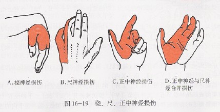 手外科方向优秀论文选题